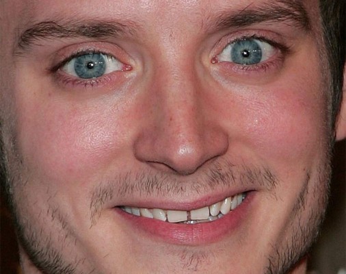 Fotogalería: Los defectos físicos más sorprendentes de los famosos