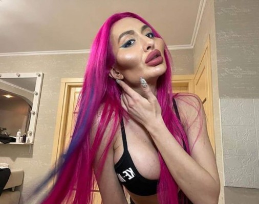 Anastasia Pokreshchuk, la mujer con los pómulos más grandes del mundo (FOTOS)