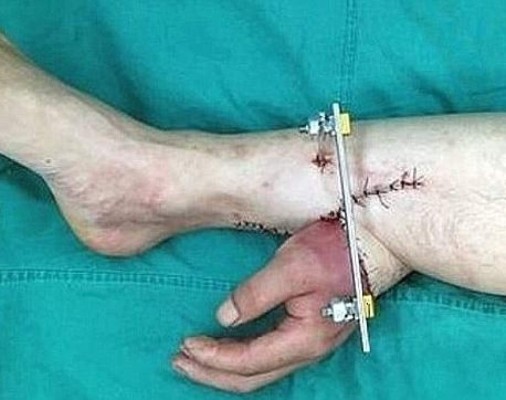 Cocen mano en pierna