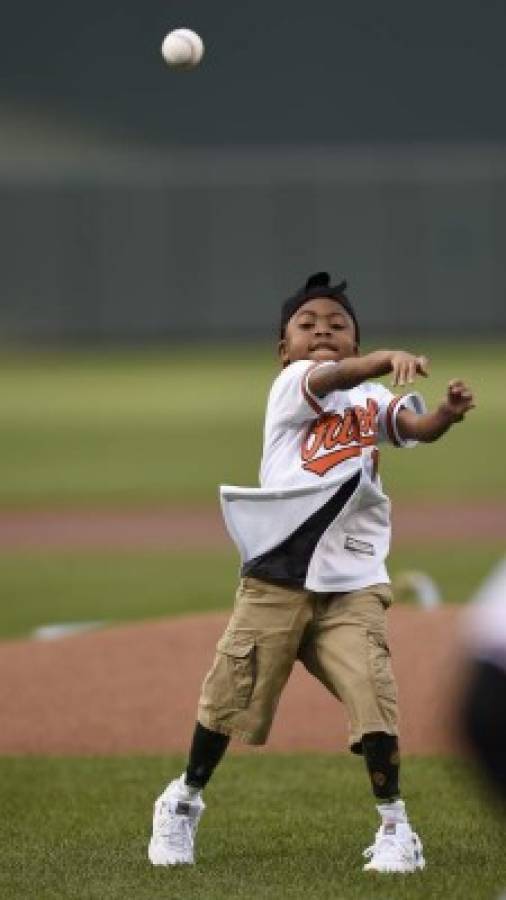 Zion Harvey presumió sus nuevas habilidades al realizar el primer lanzamiento en un juego del equipo de béisbol Orioles de esa ciudad (Foto: AP)