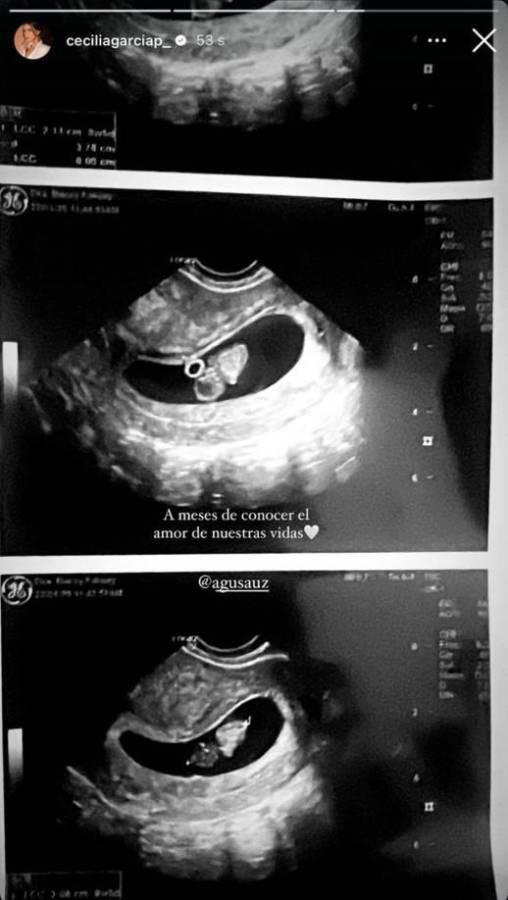 Cecilia García revela cómo se dio cuenta que estaba embarazada de Agustín Auzmendi