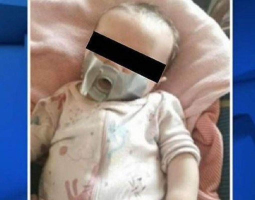 Abuelos pegan chupón con cinta aislante a su nieta