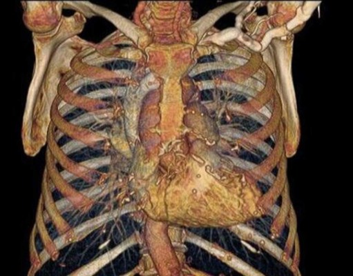 El cuerpo humano por dentro como nunca lo has visto