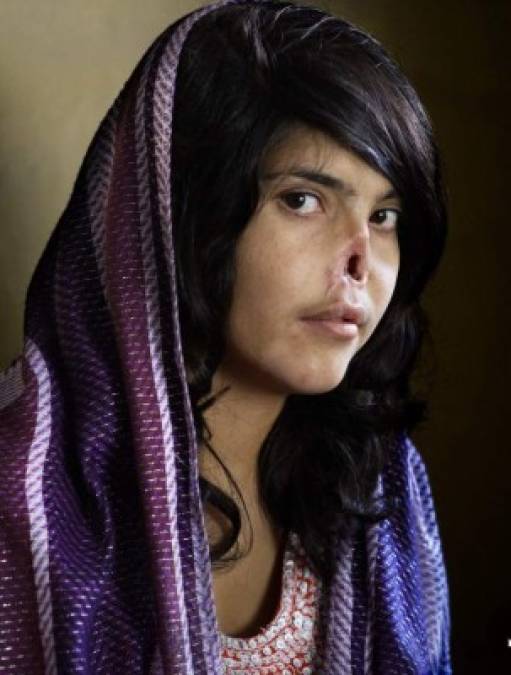 Aisha Mohammadzai, el rostro de la violencia de los talibanes contra las mujeres en Afganistán