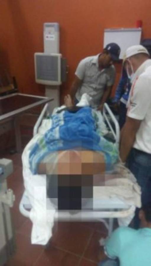 Carro 'fantasma' atropella a cinco personas y se da a la fuga en Nacaome