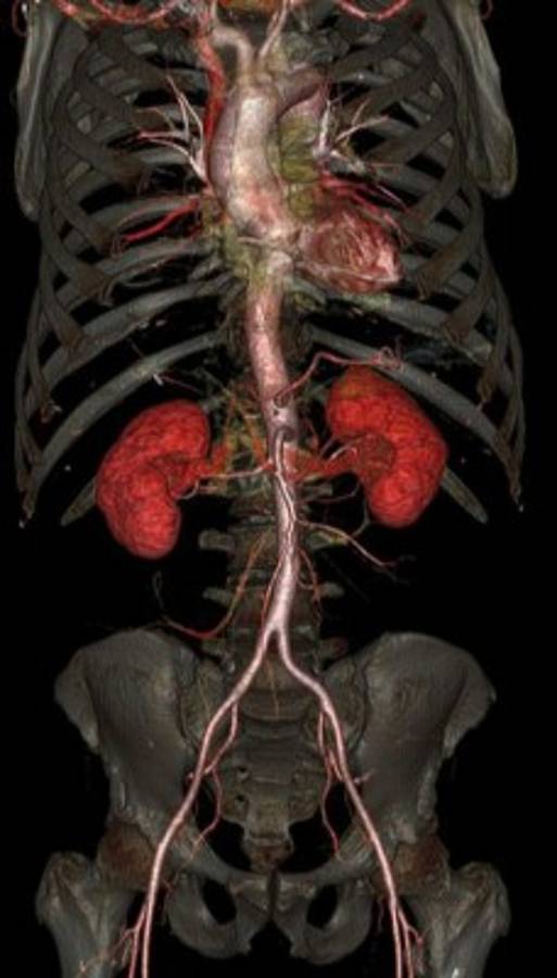 El cuerpo humano por dentro como nunca lo has visto