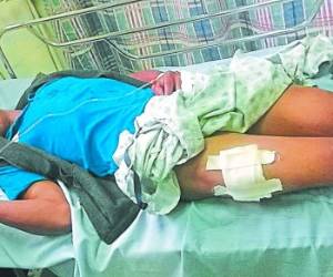 1-Olvin Hernández sobrevivió al mortal ataque y recibe atención médica en un centro hospitalario, en donde es custodiado por policías.