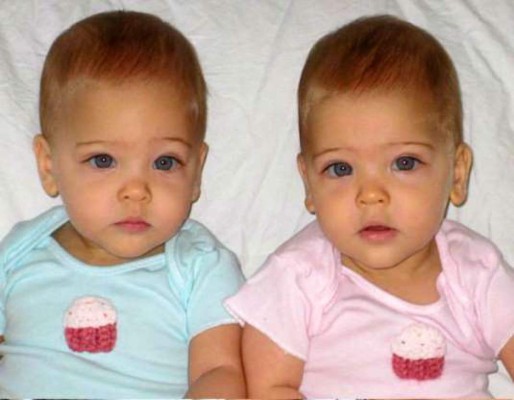 FOTOS: Los datos que debes saber sobre las gemelas más bellas del mundo