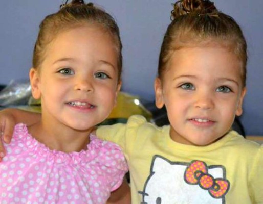 FOTOS: Los datos que debes saber sobre las gemelas más bellas del mundo