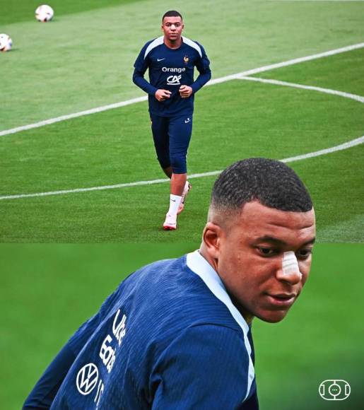 Kylian Mbappé: Así ha entrenado con Francia tras facturarse la nariz en la Eurocopa