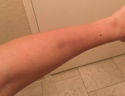 Periodista de origen hondureño agredida por director de la campaña de Trump&nbsp;&nbsp;