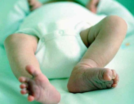 Bebé nace sin ano