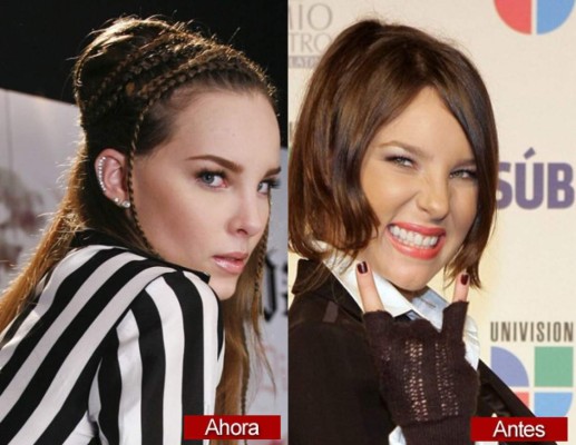El antes y después de Belinda