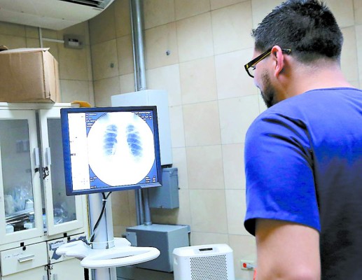 Sin placas para radiografías