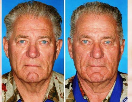 Gemelo no fumador, gemelo fumador: los estragos del cigarrillo