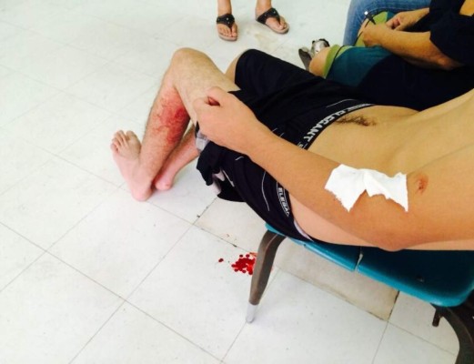 Dos muertos en tiroteo de supuestos 'Revos' en la capital de Honduras