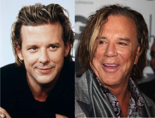 Cirujanos plásticos que hicieron desastres con los famosos