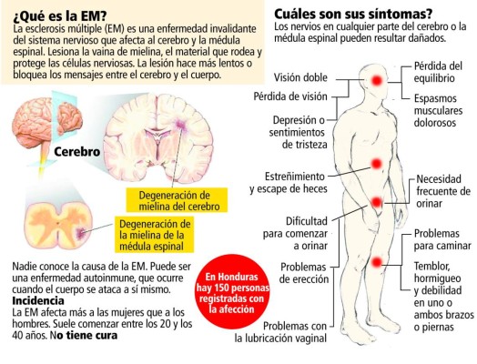 Pacientes con esclerosis múltiple piden auxilio