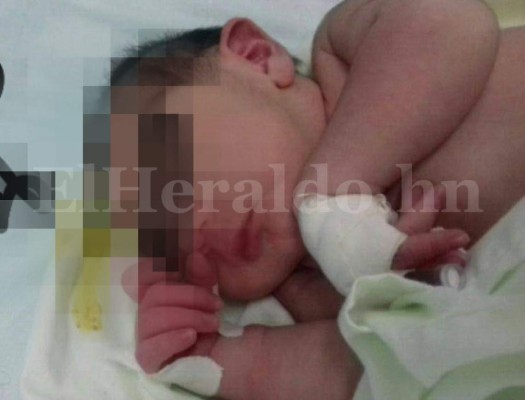 Honduras: Salud declara emergencia por casos de microcefalia en Choluteca