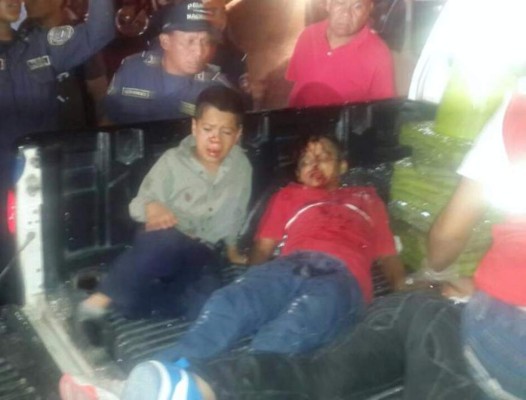 Al menos siete menores lesionados tras choque de microbuses