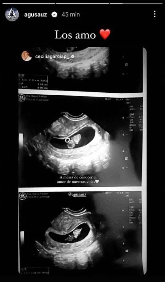 Cecilia García confirma que está embarazada de Agustín Auzmendi ¿Se va para Argentina?