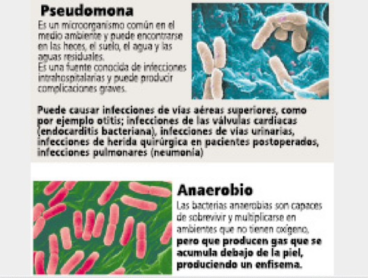 Honduras: Estudiarán bacterias 'altamente asesinas'