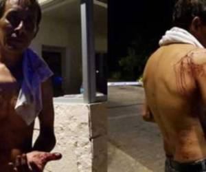 Simón Madrid Rodríguez, de 36 años de edad, se salvó de morir devorado por un cocodrilo en una laguna de México.