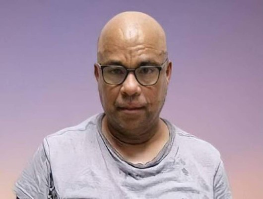 Yanelis Arias, la madre que fue rociada con ácido y murió tras el cruel ataque