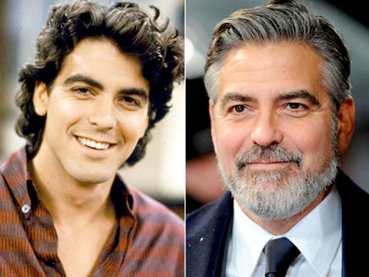 El antes y después de los famosos