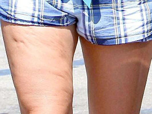 Britney Spears modela sus piernas con celulitis