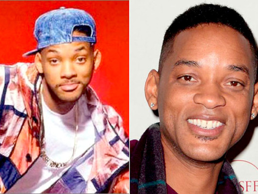 El antes y después de los famosos