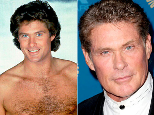 El antes y después de los famosos