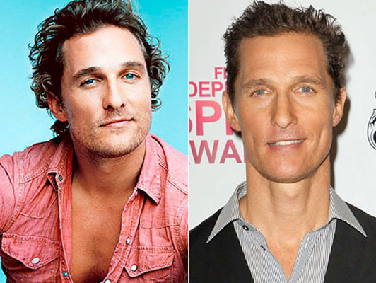 El antes y después de los famosos