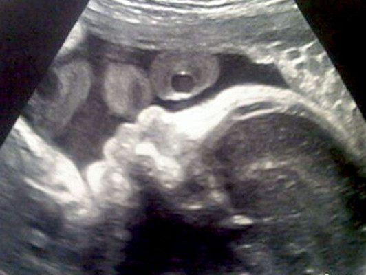 El bebé de Shakira y Piqué hace su debut mediático