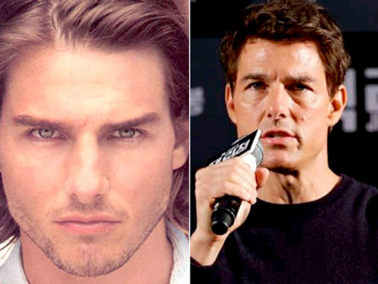 El antes y después de los famosos