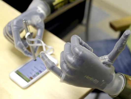 La mano biónica que es controlada desde una aplicación móvil