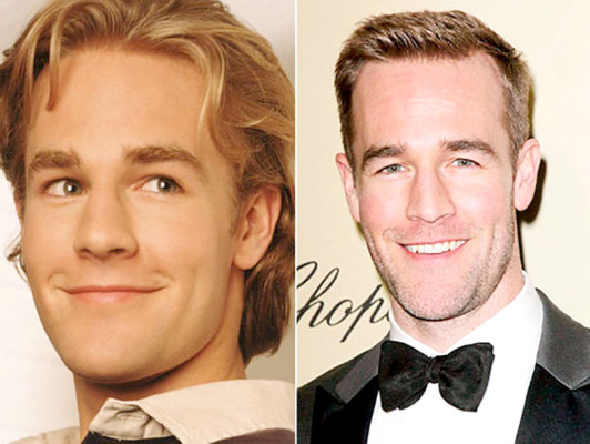 El antes y después de los famosos