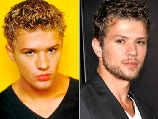 El antes y después de los famosos