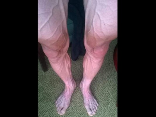Ciclista muestra foto de sus piernas tras 18 etapas del Tour de Francia