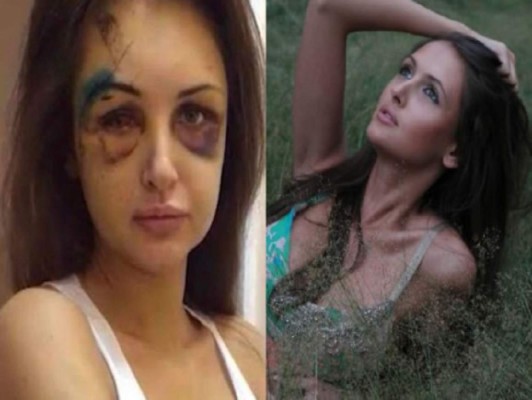 Policía busca a multimillonario que golpeó a su novia