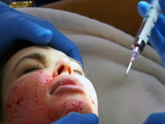 La cara ensangrentada de Kim Kardashian