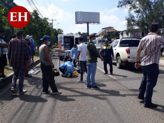 Atropellan a anciano en el anillo periférico de la capital