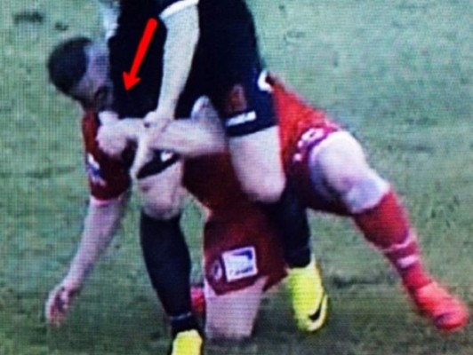 VIDEO: Jugador del Bari le muerde la pierna a rival