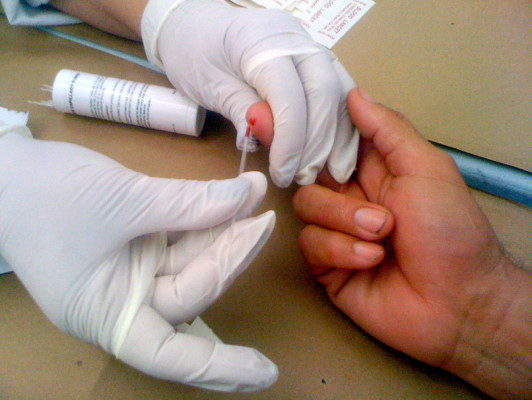 Pruebas para detectar el sida en pocos minutos