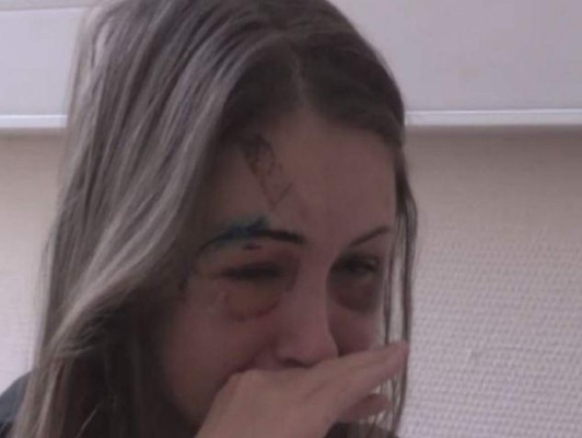 Policía busca a multimillonario que golpeó a su novia