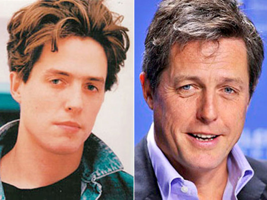 El antes y después de los famosos