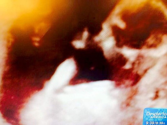 Satcha Pretto anuncia su embarazo