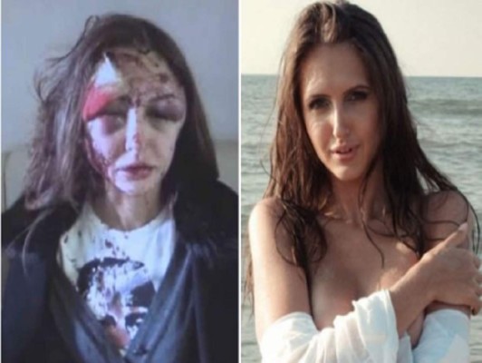 Policía busca a multimillonario que golpeó a su novia