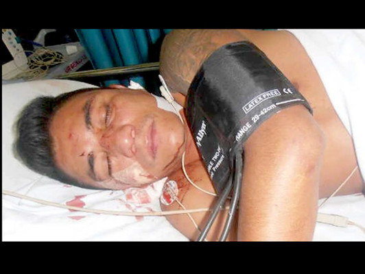 Lo golpean por villano