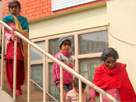 Familia 'hombre lobo'